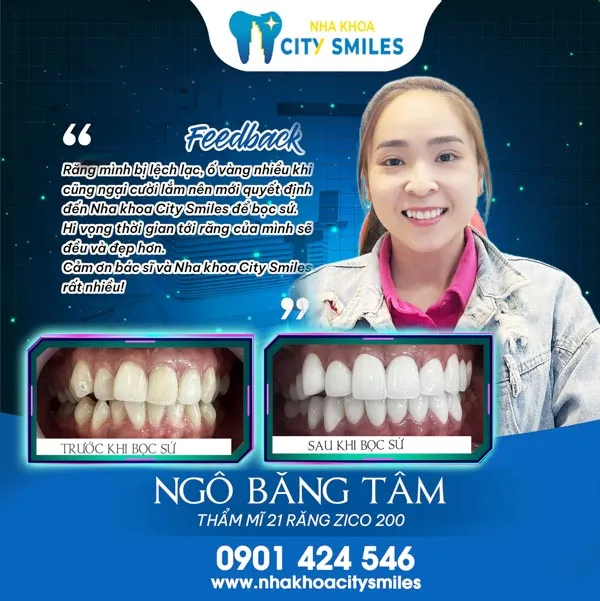 Sản phẩm fb1 — Công Ty Cổ Phần City Smiles — MST 0317541463