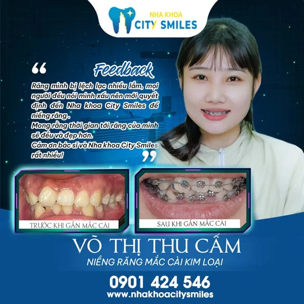 Sản phẩm fb2 — Công Ty Cổ Phần City Smiles — MST 0317541463