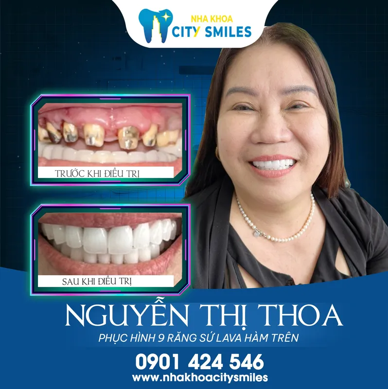Sản phẩm hinh khach hang nha khoa city smiles 1 — Công Ty Cổ Phần City Smiles — MST 0317541463