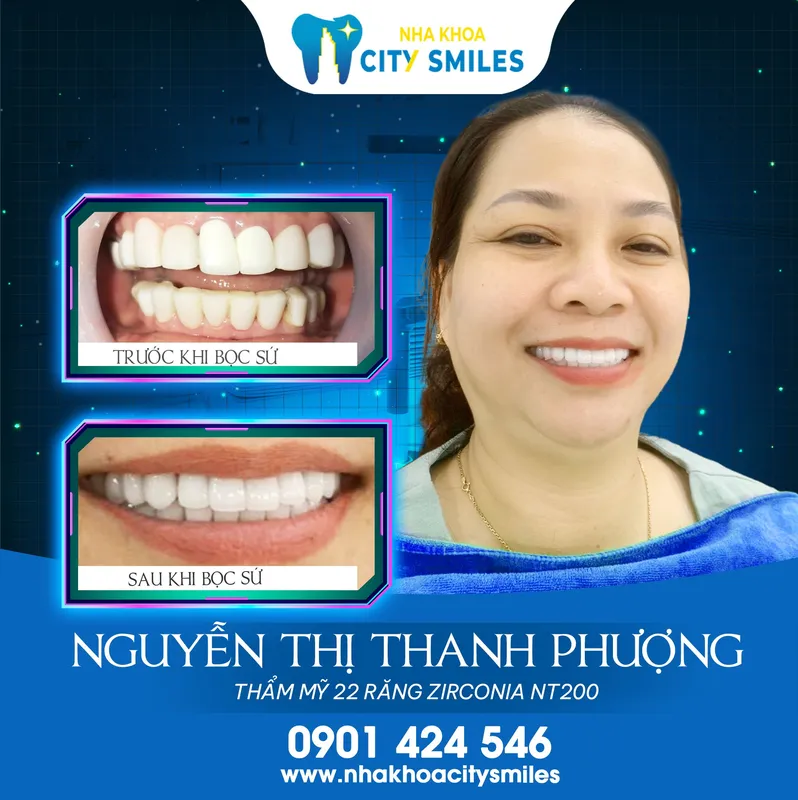 Sản phẩm hinh khach hang nha khoa city smiles 2 — Công Ty Cổ Phần City Smiles — MST 0317541463