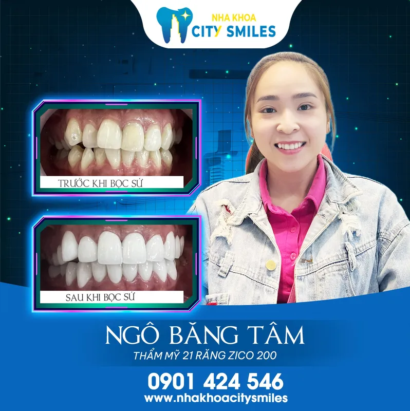 Sản phẩm hinh khach hang nha khoa city smiles 3 — Công Ty Cổ Phần City Smiles — MST 0317541463