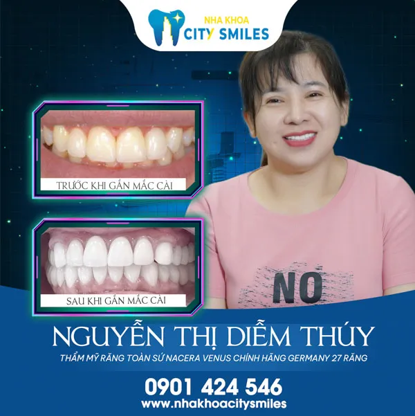 Sản phẩm moi nua nua ne — Công Ty Cổ Phần City Smiles — MST 0317541463