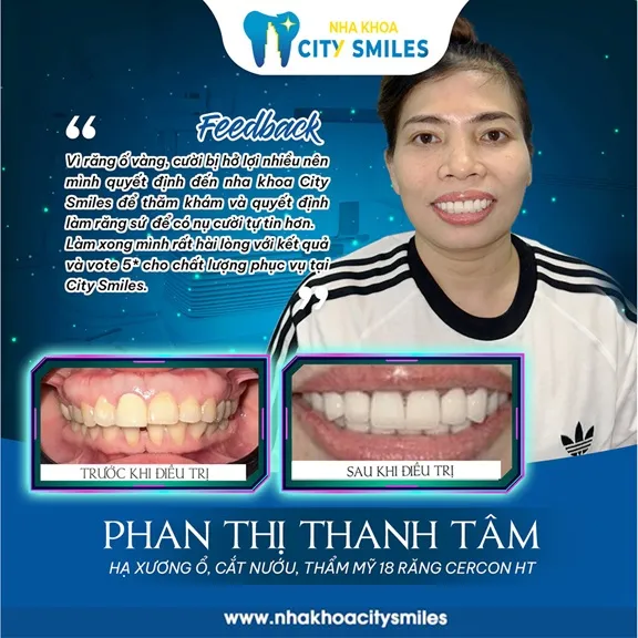 Sản phẩm hinh anh khach hang city smiles — Công Ty Cổ Phần City Smiles — MST 0317541463