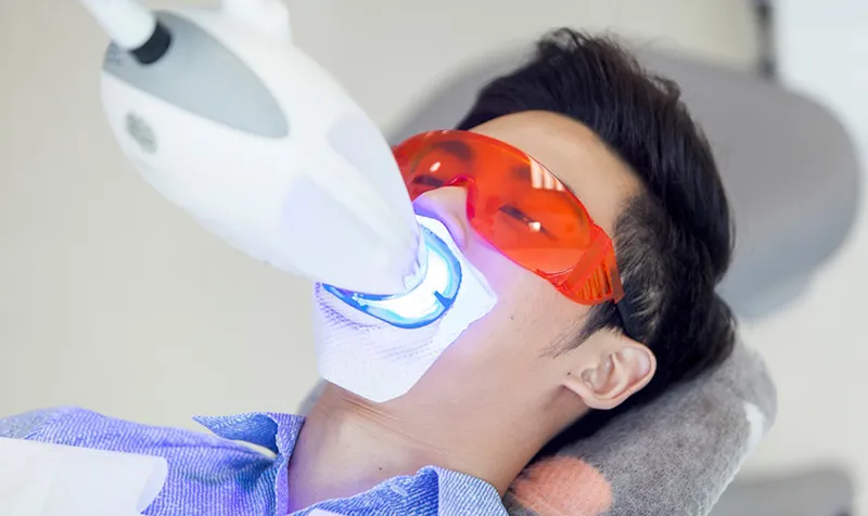 Sản phẩm co nen tay trang rang tai nha khoa so sanh voi tay trang rang tai nha duoi goc nhin chuyen mon — Công Ty Cổ Phần City Smiles — MST 0317541463