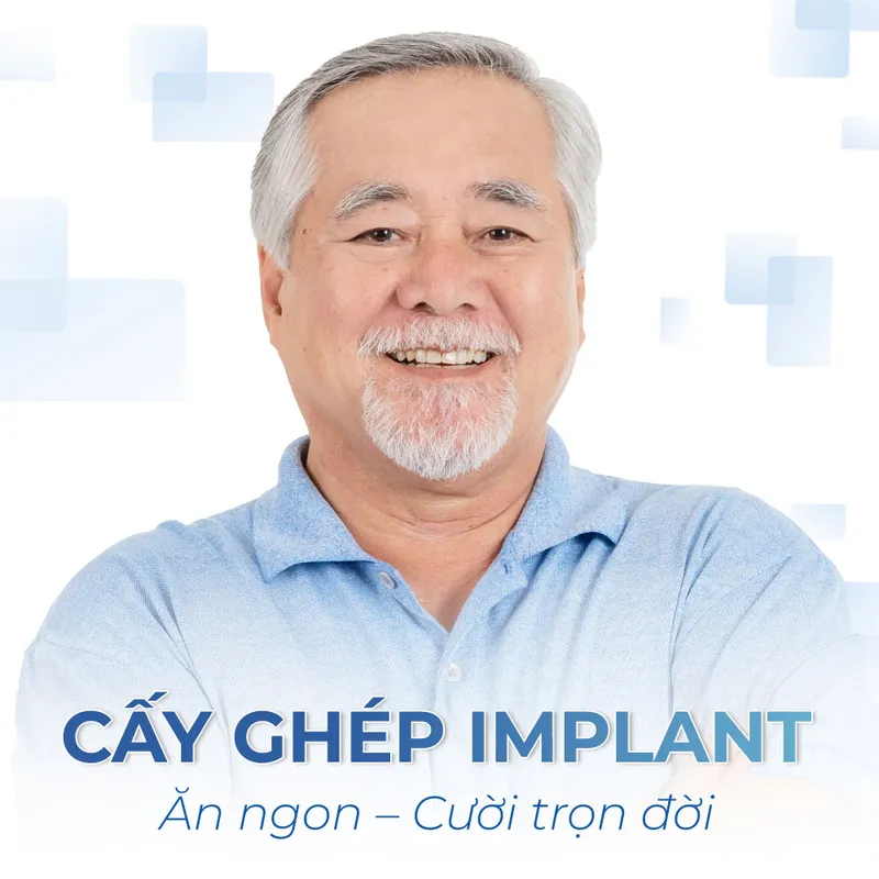 Sản phẩm cayghepimplant1 — Công Ty TNHH Dịch Vụ Nha Khoa Quốc Tế Sài Gòn — MST 0317959356
