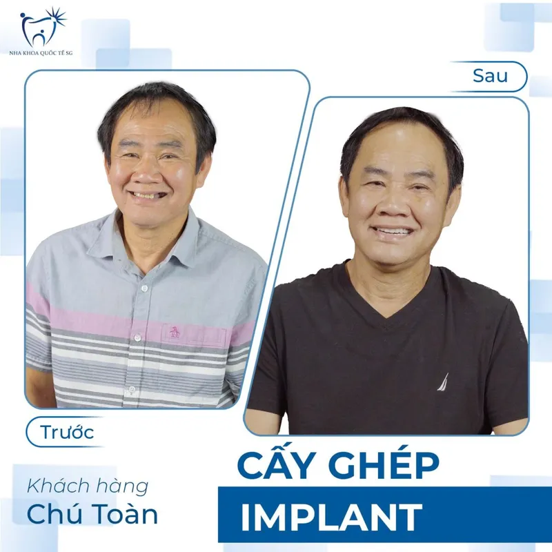Sản phẩm ketquadieutri 1200x1200 — Công Ty TNHH Dịch Vụ Nha Khoa Quốc Tế Sài Gòn — MST 0317959356