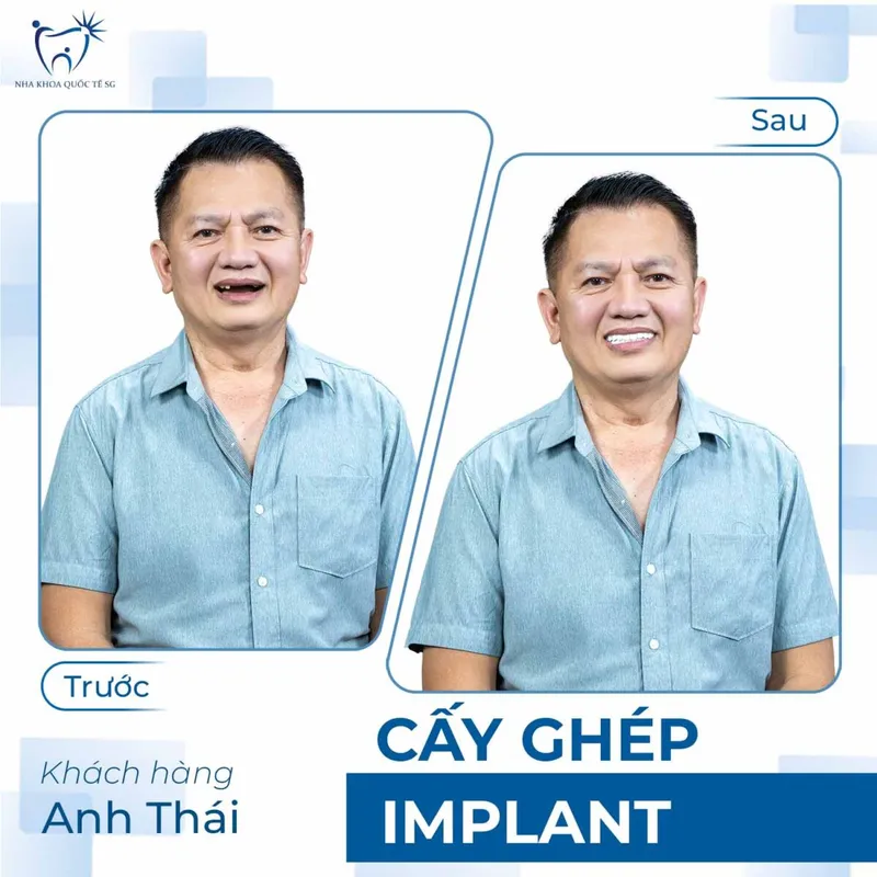 Sản phẩm ketquadieutri2 1200x1200 — Công Ty TNHH Dịch Vụ Nha Khoa Quốc Tế Sài Gòn — MST 0317959356