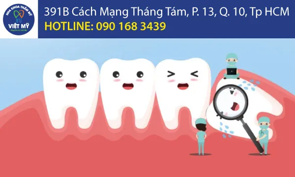 Sản phẩm nha khoa tham my viet my cham soc rang khon — Nha Khoa Thẩm Mỹ Việt Mỹ - Công Ty TNHH MTV Nha Khoa Thẩm Mỹ Việt Mỹ — MST 0318104307