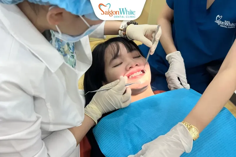 Sản phẩm Dich vu nieng rang tai nha khoa Sai Gon White 1_11zon 1024x683 — Nha Khoa Sài Gòn White - Công Ty TNHH Nha Khoa Sài Gòn White — MST 0318885153