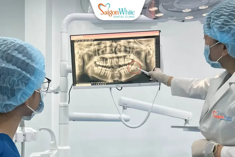 Sản phẩm nho rang khon_11zon 1024x683 — Nha Khoa Sài Gòn White - Công Ty TNHH Nha Khoa Sài Gòn White — MST 0318885153
