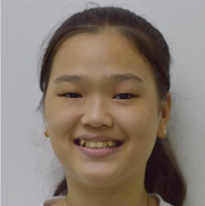 Sản phẩm Huynh Yen Nhi.pptx e1766565228992 — Nha Khoa IDC Danang - Công Ty TNHH MTV Nha Khoa Quốc Tế — MST 0401307133