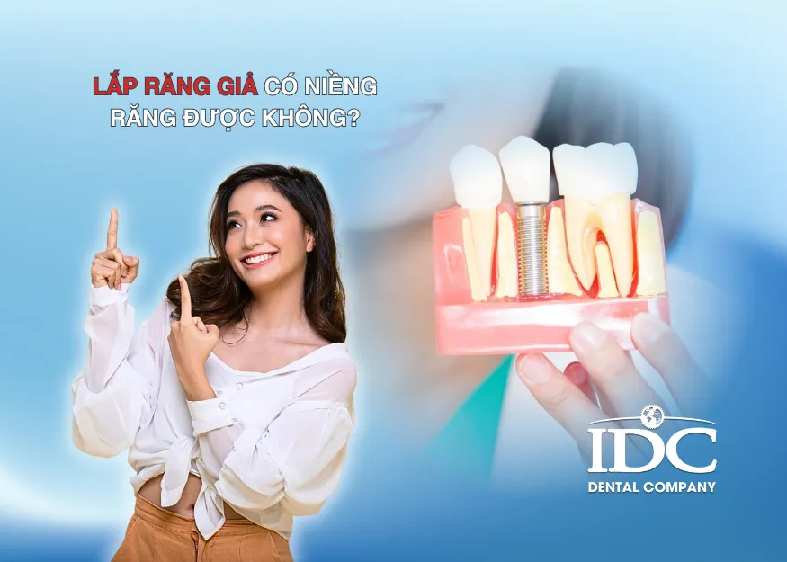 Sản phẩm lap rang gia co nieng rang duoc khong — Nha Khoa IDC Danang - Công Ty TNHH MTV Nha Khoa Quốc Tế — MST 0401307133