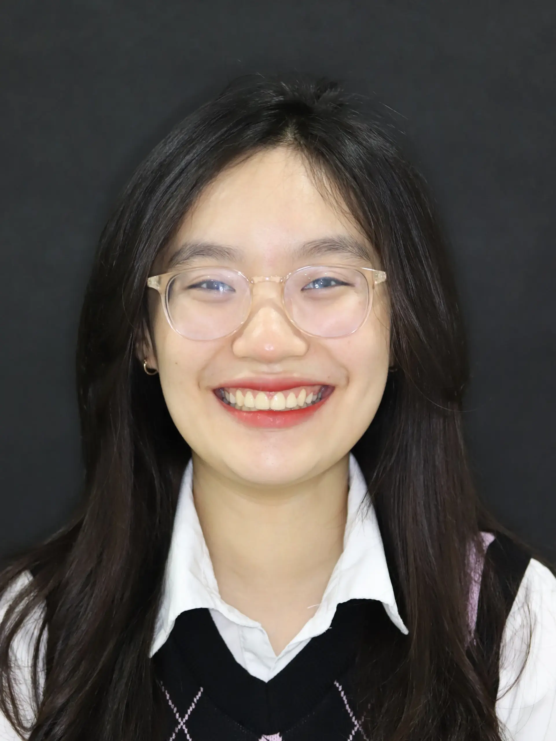 Sản phẩm Pham Quynh Chau after scaled — Nha Khoa IDC Danang - Công Ty TNHH MTV Nha Khoa Quốc Tế — MST 0401307133