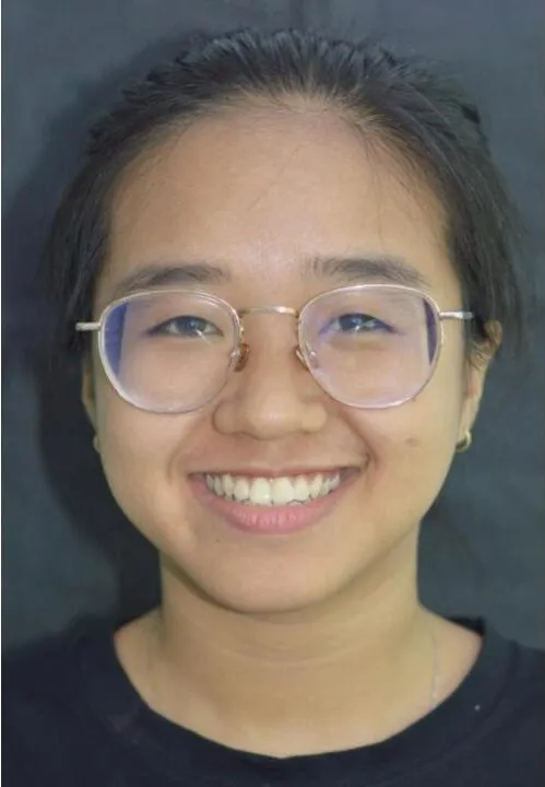 Sản phẩm Tran Le Linh Kha.pptx e1766619505923 — Nha Khoa IDC Danang - Công Ty TNHH MTV Nha Khoa Quốc Tế — MST 0401307133
