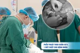 Sản phẩm 270_crop__PHYU_THUYT_THAO_XOYN_CYU_1_MET_RUYT_CHO_BYNH_NHAN — Công Ty TNHH Một Thành Viên Bệnh Viện Đa Khoa Tâm Trí Đà Nẵng — MST 0401506925