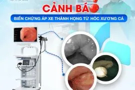 Sản phẩm 270_crop__POST_NYI_SOI — Công Ty TNHH Một Thành Viên Bệnh Viện Đa Khoa Tâm Trí Đà Nẵng — MST 0401506925