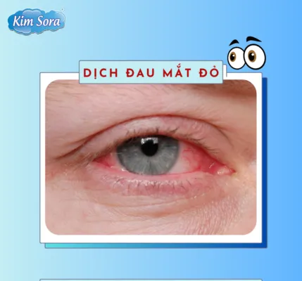 Sản phẩm 1 e1694665215566 429x400 — May Mặc Kim Sora - Công Ty Cổ Phần Kim Sora — MST 0401698328