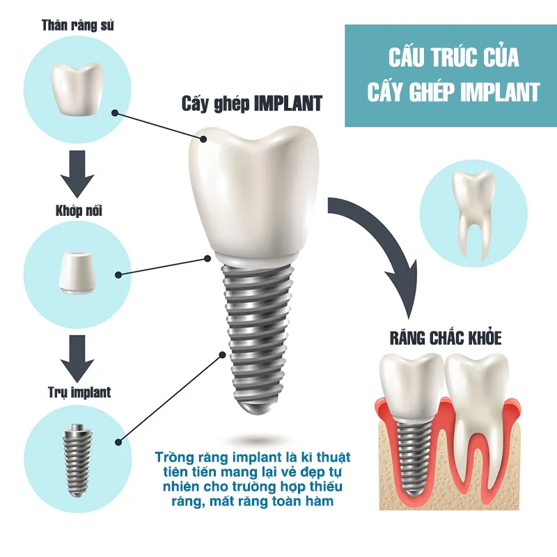 Sản phẩm thanh phan cau tao implant — Công Ty TNHH Nha Khoa Dana — MST 0402161656