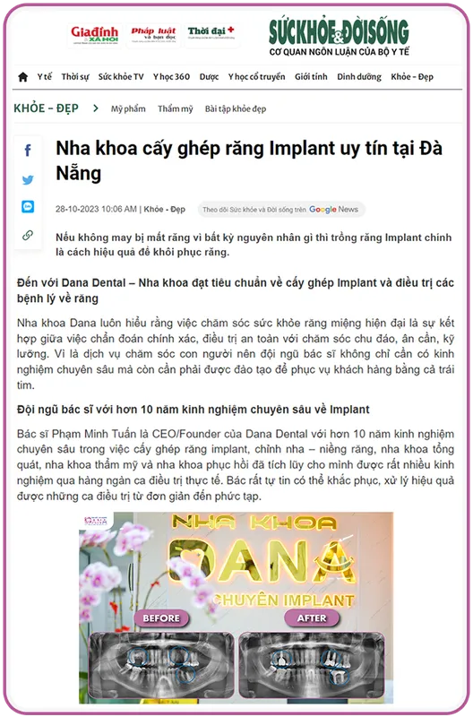Sản phẩm bao suc khoe doi song noi ve nha khoa dana — Công Ty TNHH Nha Khoa Dana — MST 0402161656