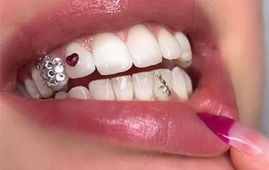 Sản phẩm Dinh da rang — Công Ty TNHH RUBY DENTAL — MST 1001223924