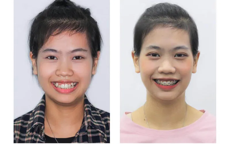 Sản phẩm Khach hang 17 — Công Ty TNHH RUBY DENTAL — MST 1001223924