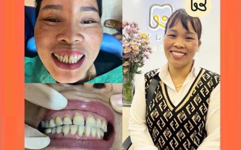 Sản phẩm khach hang 02 — Công Ty TNHH RUBY DENTAL — MST 1001223924