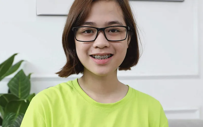 Sản phẩm khach hang 12 — Công Ty TNHH RUBY DENTAL — MST 1001223924