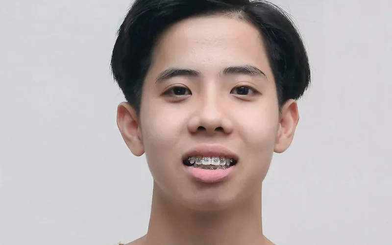Sản phẩm khach hang 13 — Công Ty TNHH RUBY DENTAL — MST 1001223924