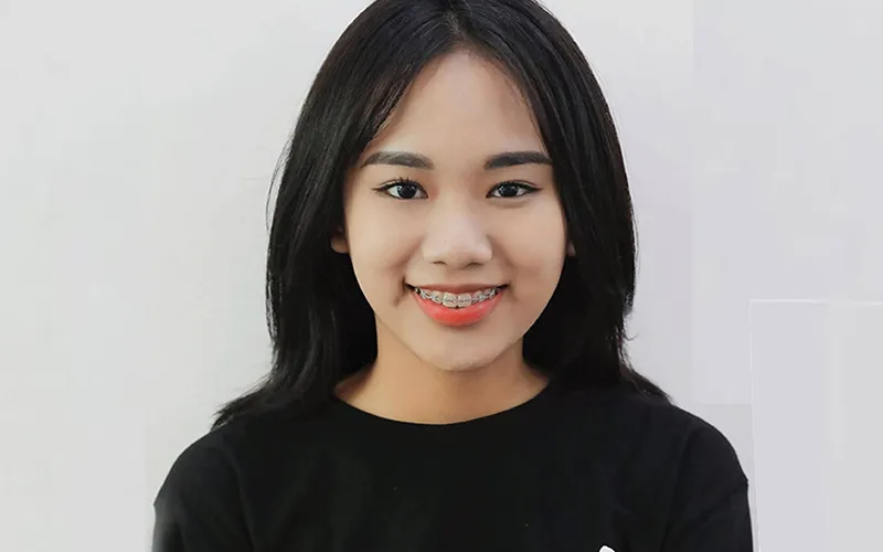 Sản phẩm khach hang 14 — Công Ty TNHH RUBY DENTAL — MST 1001223924