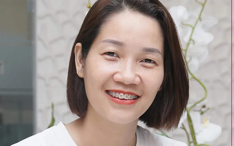 Sản phẩm khach hang 15 — Công Ty TNHH RUBY DENTAL — MST 1001223924