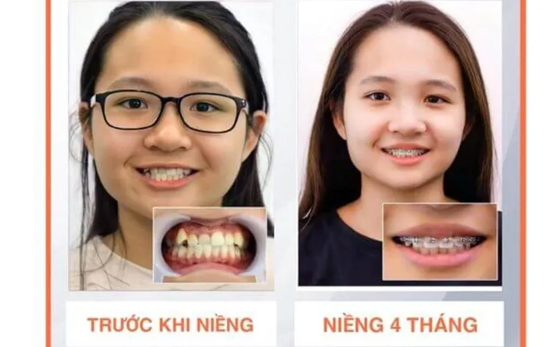 Sản phẩm khach hang 7 — Công Ty TNHH RUBY DENTAL — MST 1001223924