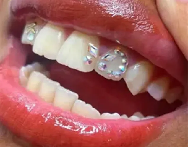 Sản phẩm DInh da rang nam — Công Ty TNHH RUBY DENTAL — MST 1001223924