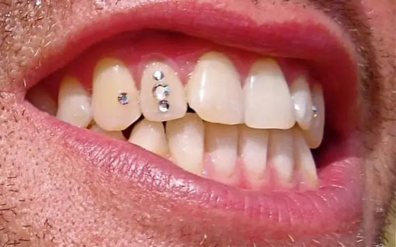 Sản phẩm dinh da rang cua — Công Ty TNHH RUBY DENTAL — MST 1001223924