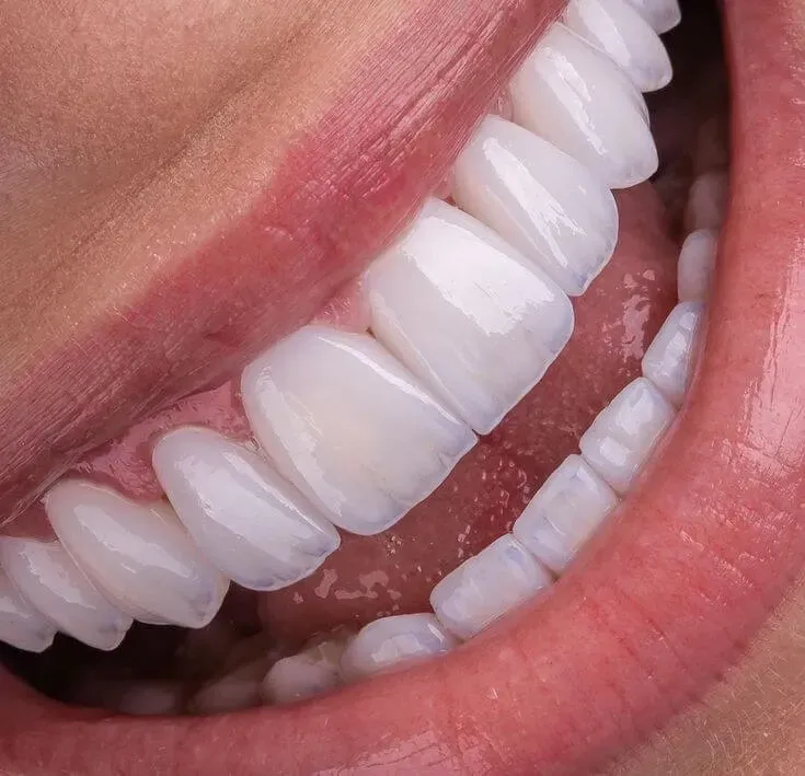Sản phẩm nho rang so 4 bi hop ma 7 — Công Ty TNHH RUBY DENTAL — MST 1001223924