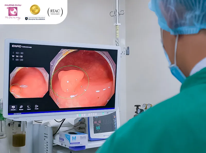 Sản phẩm noi soi tri tue nhan tao thum — Chi Nhánh Công Ty Cổ Phần Đầu Tư Và Thương Mại Phương Châu — MST 1800651309