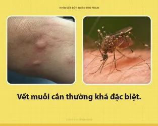 Sản phẩm untitled 7 1535360472459370057625 313x250 — Trừ Mối An Bình - Công Ty TNHH Phòng Trừ Mối & Côn Trùng Gây Hại An Bình — MST 2801673829
