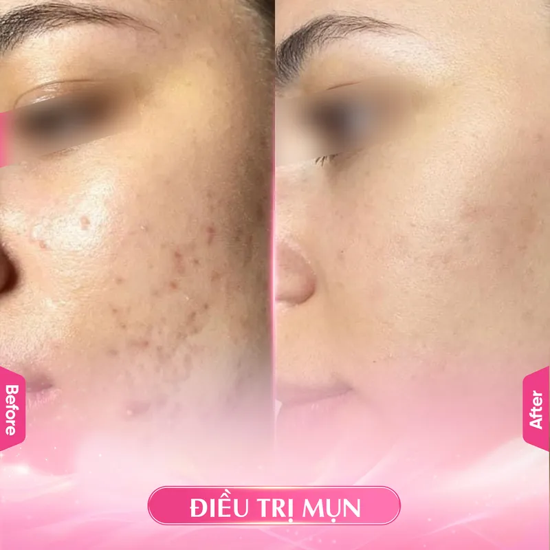 Sản phẩm MUN — Công Ty TNHH Ladys House — MST 3702504003