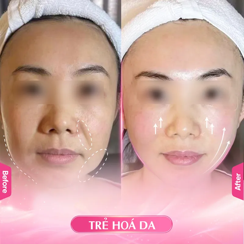 Sản phẩm TRE HOA DA — Công Ty TNHH Ladys House — MST 3702504003