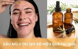 Sản phẩm dau mu u tri seo 3 300x188 — Công Ty TNHH MTV Thẩm Mỹ Viện ULA — MST 3702598386