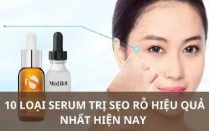 Sản phẩm serum tri seo ro 300x188 — Công Ty TNHH MTV Thẩm Mỹ Viện ULA — MST 3702598386