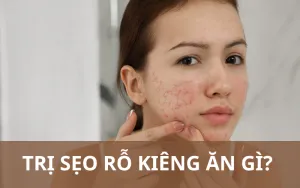 Sản phẩm tri seo ro kieng an gi 12 300x188 — Công Ty TNHH MTV Thẩm Mỹ Viện ULA — MST 3702598386