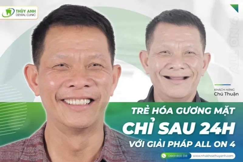 Sản phẩm trong rang gia cho nguoi lon tuoi 1 e1628648267558 — Nha Khoa Thùy Anh — MST 4601323323