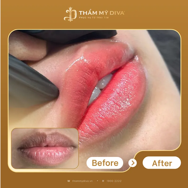 Sản phẩm 01_23_ADS_MÔI_MÔI_COLLAGEN_–_CĂNG_BÓNG_TỨC_THÌ_04 scaled — Công Ty Cổ Phần Tập Đoàn Diva Group — MST 5801358357